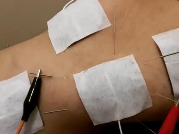 Ariana Mollica - Acupunturista em Volta Redonda